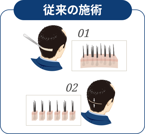 従来の施術