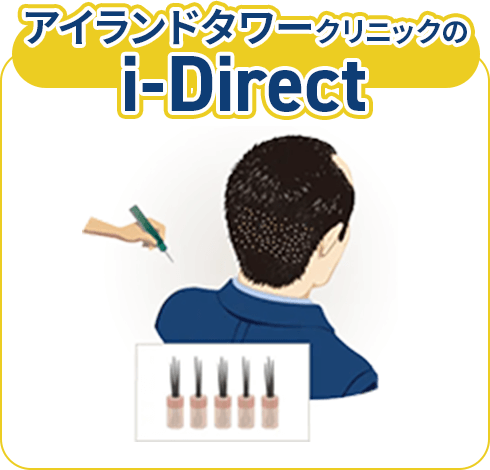 アイランドタワークリニックのi-Direct