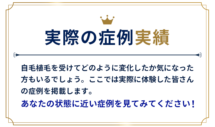 実際の症例実績。自毛植毛を受けてどのように変化したか気になった方もいるでしょう。ここでは実際に体験した皆さんの症例を掲載します。あなたの状態に近い症例を見てみてください！