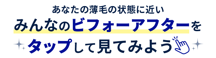 タップしてあなたの薄毛の状態に近いみんなのビフォーアフターを見てみよう
